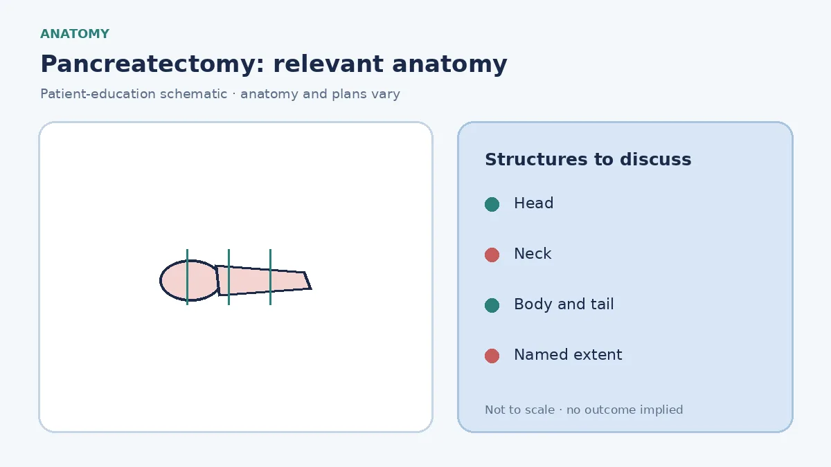 Medical illustration of the whole pancreas showing head, neck, body and tail so the extent of pancreatectomy can be discussed