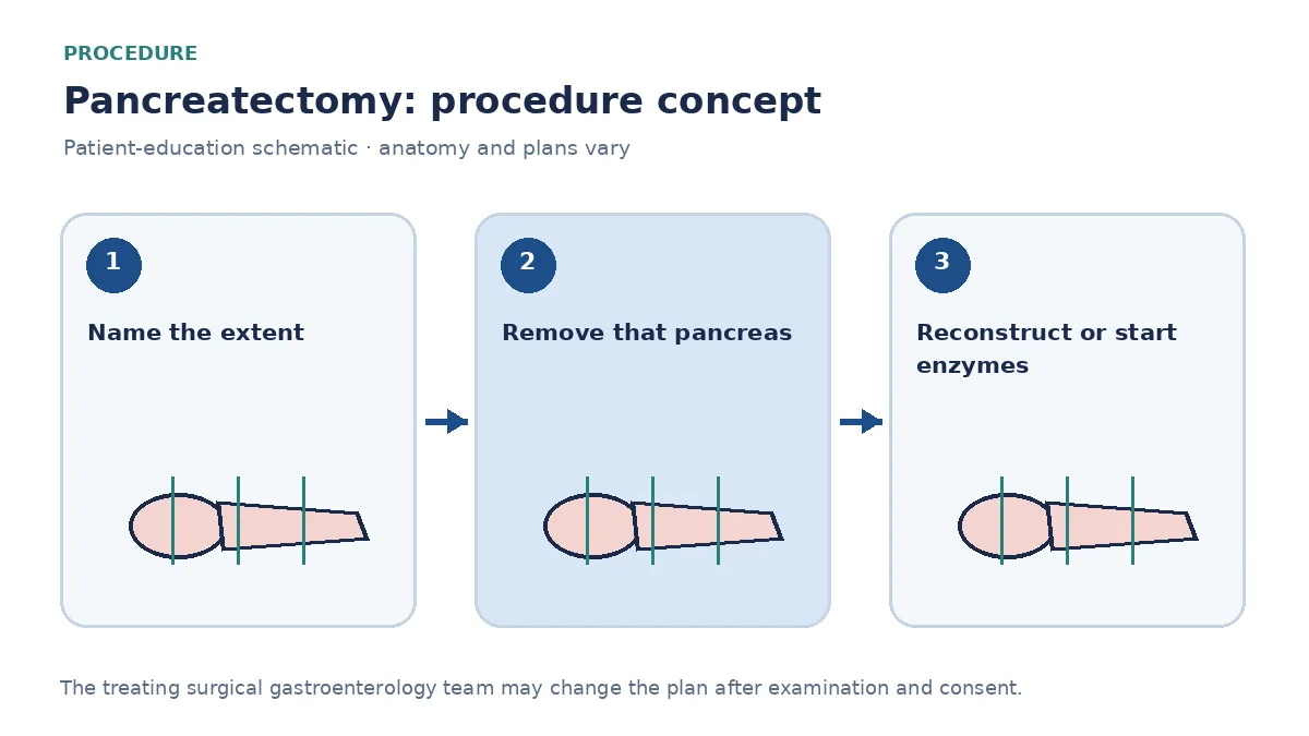 Clinical diagram comparing central, extended and total pancreatectomy concepts