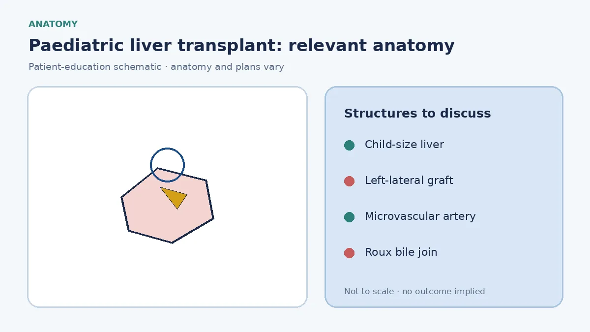 Medical illustration of a child's liver, bile ducts and a size-matched left-lateral graft used in paediatric transplantation