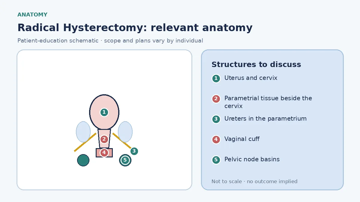 Medical illustration of pelvic anatomy for radical hysterectomy: uterus and cervix between bladder and rectum, ureters running through the parametrium, a vaginal cuff, and the pelvic node basins assessed with the specimen.