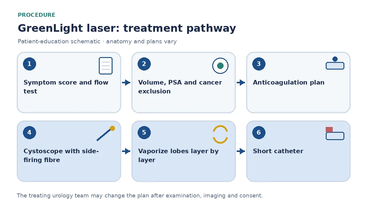 Step-by-step GreenLight laser pathway infographic showing symptom score and flow test, prostate volume and PSA review, anticoagulation plan, cystoscopic laser vaporization, coagulation and short catheter placement
